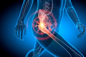 When Should You See a Hip Surgeon in Spokane for Hip Pain?
